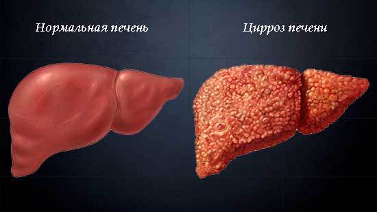 Вітаміни для печінки: при цирозі, для відновлення, очищення та жовчного міхура