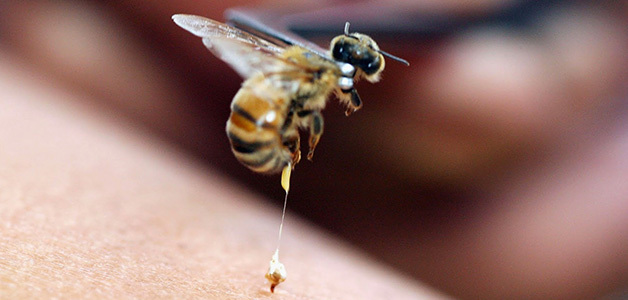 Укус бджоли: користь і шкода, перша допомога, лікування бджолиною отрутою