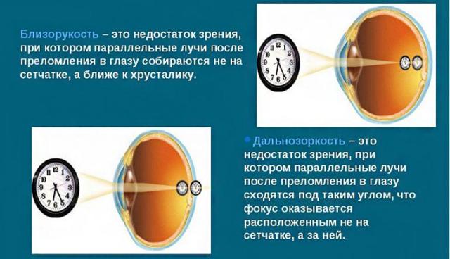 Користь і шкода комп'ютерних очок, як вибрати, відгуки