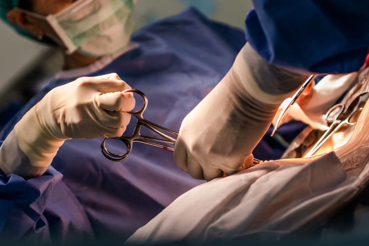 Хирургическая операция на матке аднексэктомия