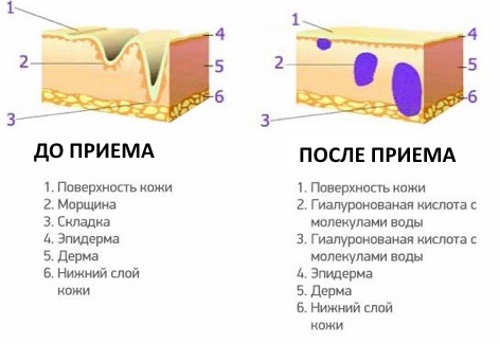 Гіалуронова кислота Вітамір: відгуки, інструкція із застосування, протипоказання