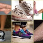 Як позбутися від запаху в кросівках: народними і спеціалізованими засобами
