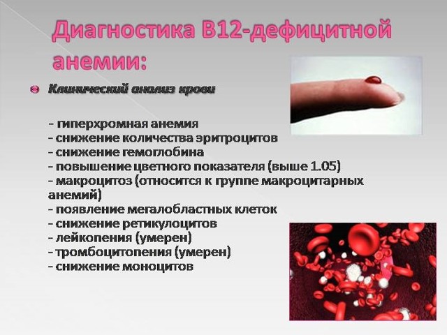 Вітамін b12: для чого потрібен жіночому організму, симптоми дефіциту і надлишку