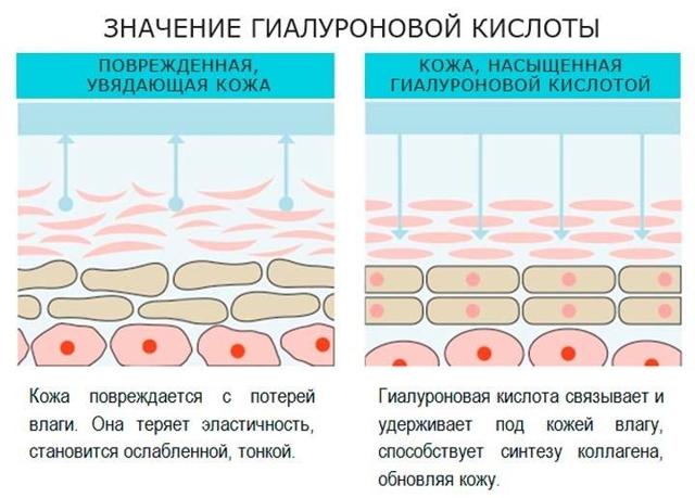 Колаген і гіалуронова кислота: в чому різниця, що краще вибрати