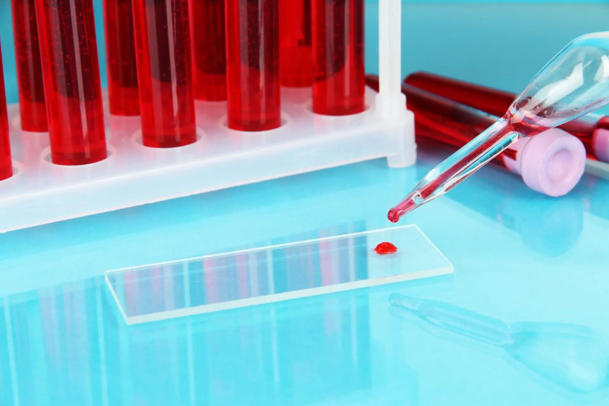 Різновиди лабораторних аналізів крові