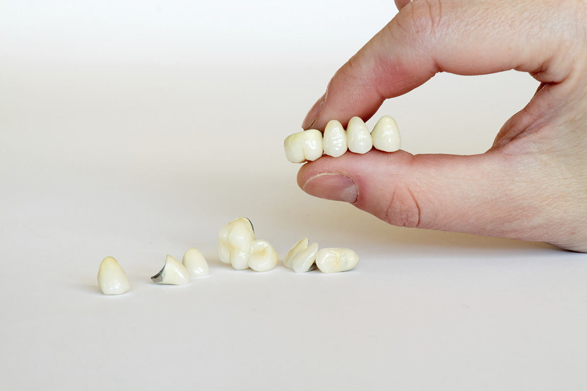 Протезування зубів коронками з високоякісної кераміки та знімними протезами 