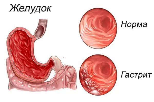 Морквяний сік: користь і шкода, як правильно пити