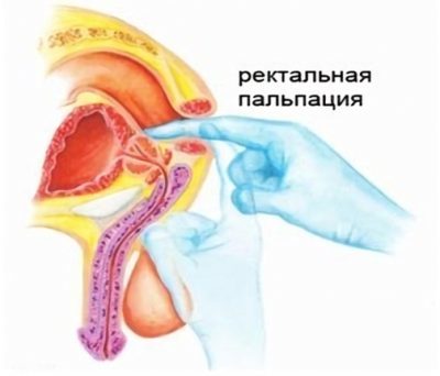 Масаж простати: користь і шкода, як робити в домашніх умовах, відгуки