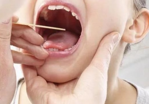 Як терміново прибрати запах цибулі з рота: чим нейтралізувати, скільки тримається