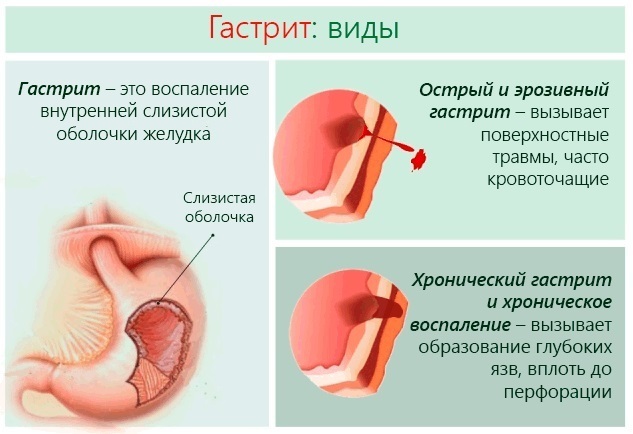 Єсентуки 4: користь і шкода, показання та протипоказання до застосування, відгуки