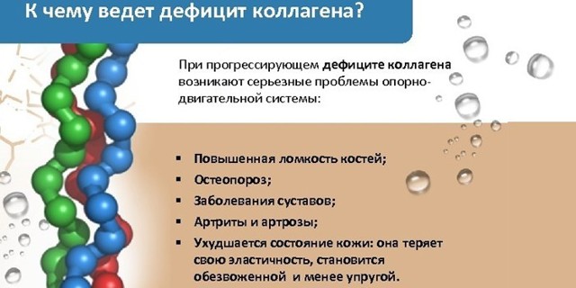 Колаген для суглобів: який краще, відгуки лікарів, інструкція із застосування