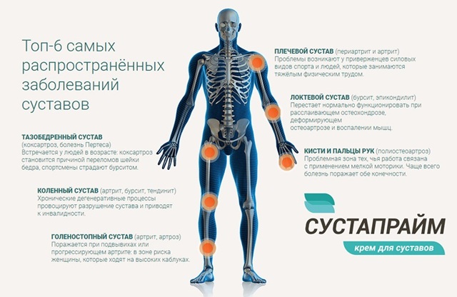 Вітаміни для суглобів і зв'язок спортсменів: які корисні і як приймати