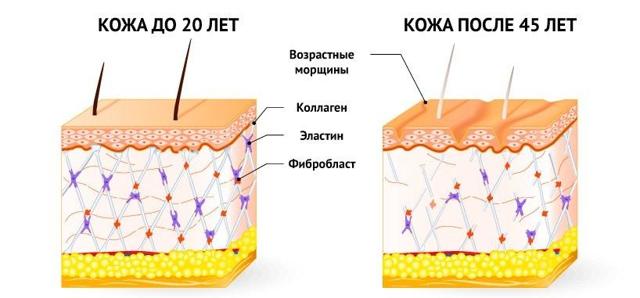 Колаген і гіалуронова кислота: в чому різниця, що краще вибрати