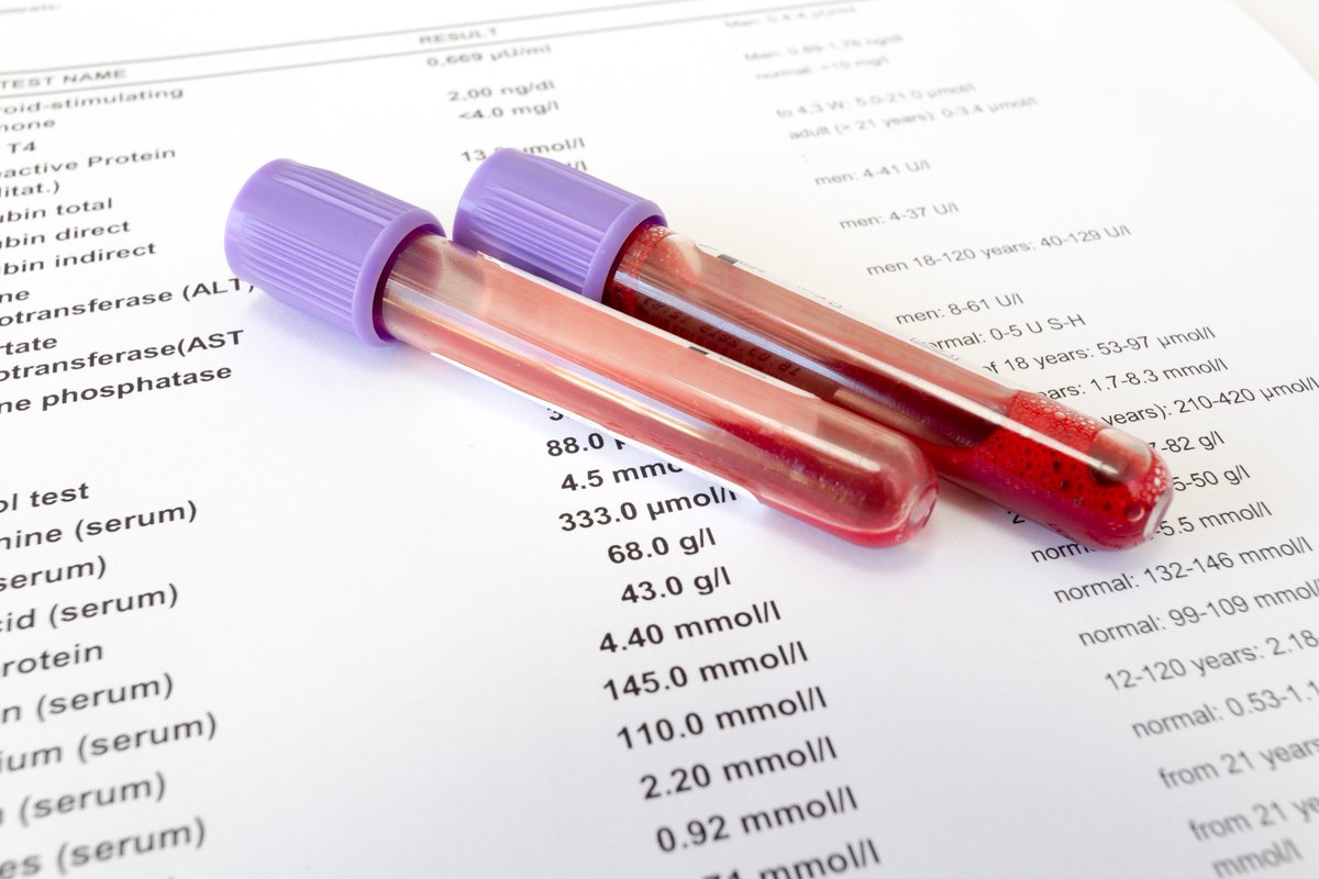 Біохімічний аналіз крові на калій