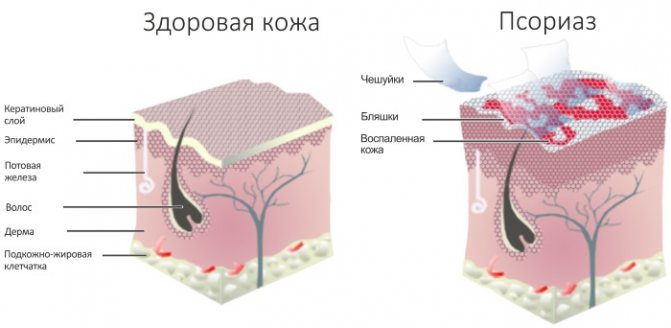 Болячки на голові в волоссі.  Фото, причини і лікування в домашніх умовах