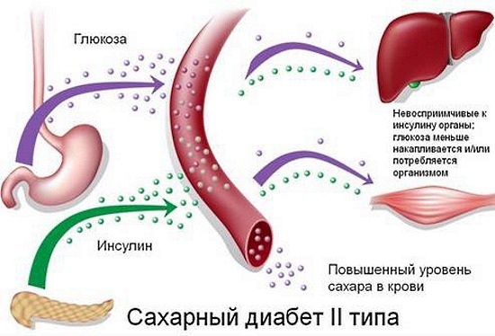 Вітаміни при діабеті Оліджім: відгуки діабетиків, інструкція із застосування