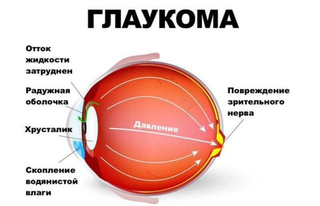 Лютеїн для очей: що це таке, користь і шкода, в яких продуктах міститься, відгуки