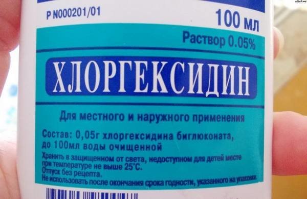 Як прибрати запах секонд-хенду з речей: чим обробити без прання, як дезінфікувати взуття