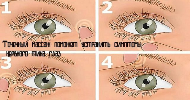 Нервовий тик очі: причини у дорослих, як швидко позбутися, відгуки