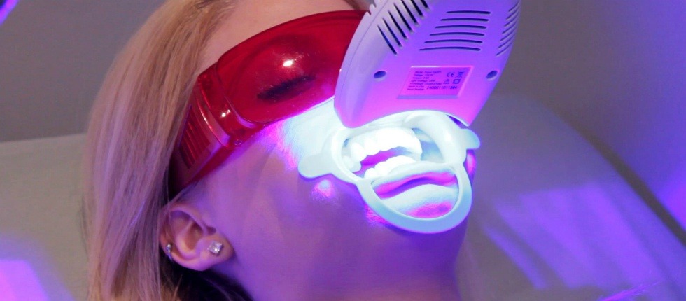 Проведення процедури фотовідбілювання зубів молодої дівчини