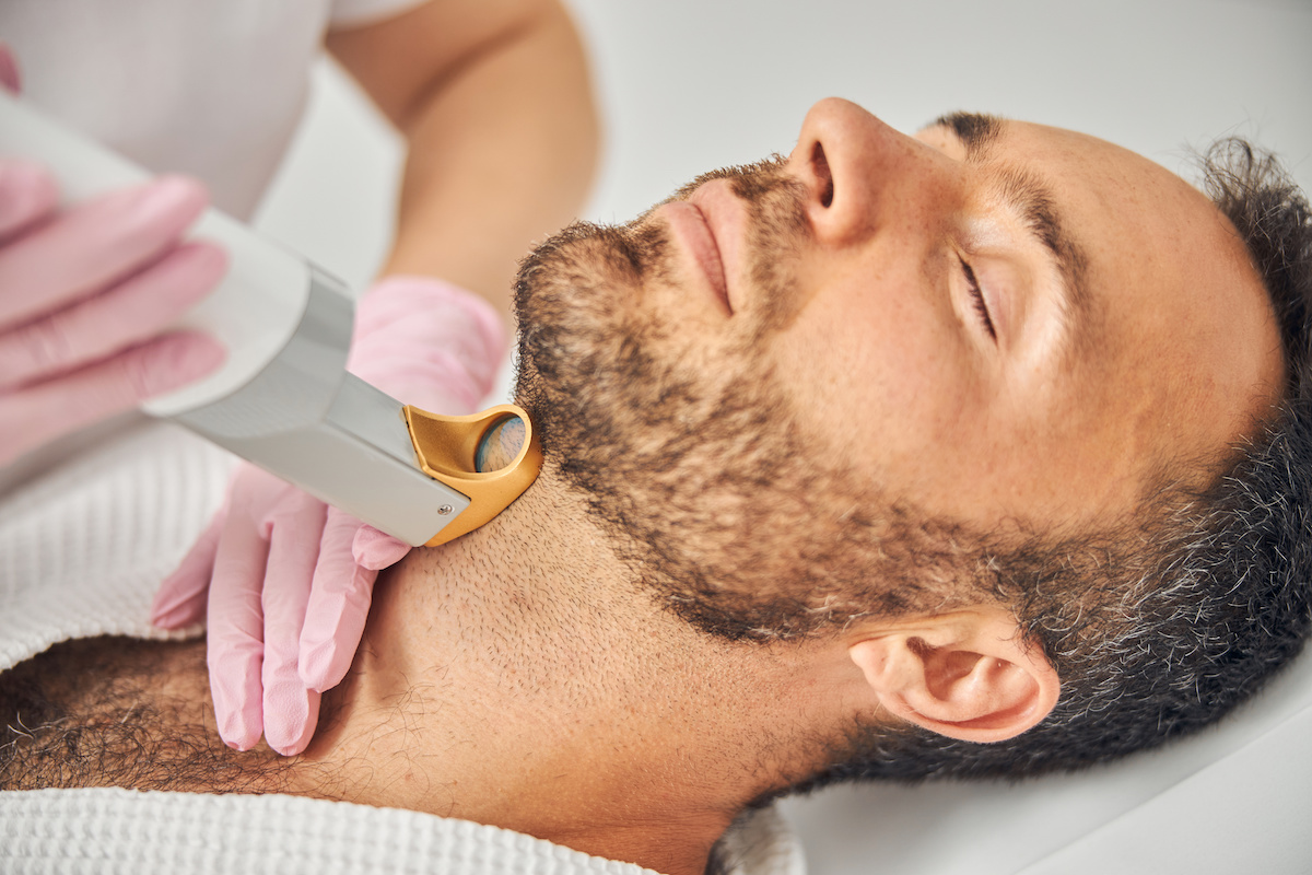 Косметолог видаляє небажане волосся з чоловічої шиї лазером