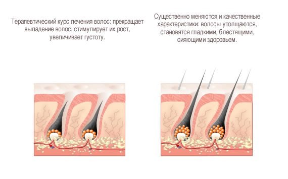 Маски для росту волосся і від випадання з димексидом і вітамінами, обліпихи, реп'яхову олію.  рецепти