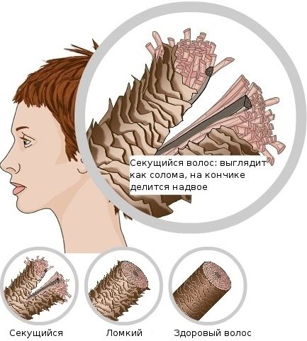 Муміє для волосся.  Властивості і застосування в косметології, як додавати в шампунь.  Відгуки трихолог і дерматологів