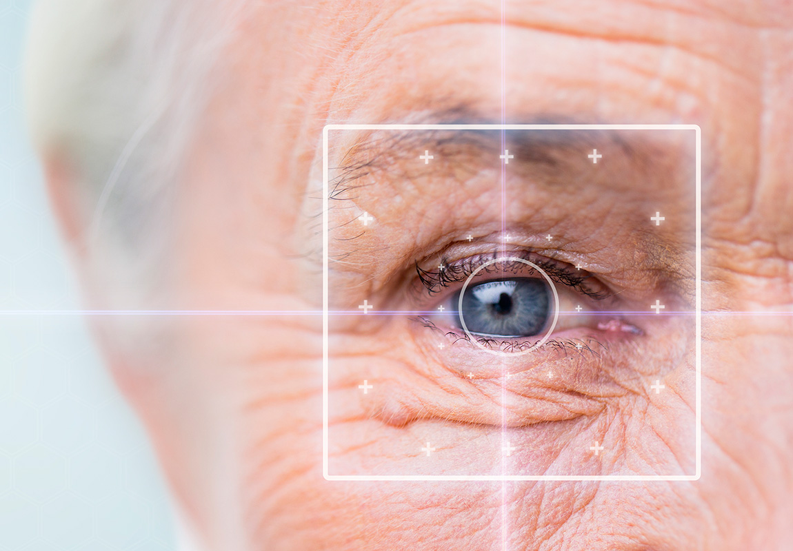 Катаракта сетчатки глаза у у пожилых людей