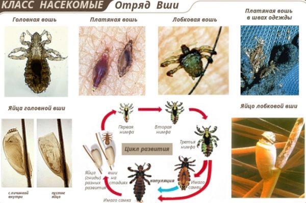 Від чого можуть з'явитися воші у людини і як вони передаються