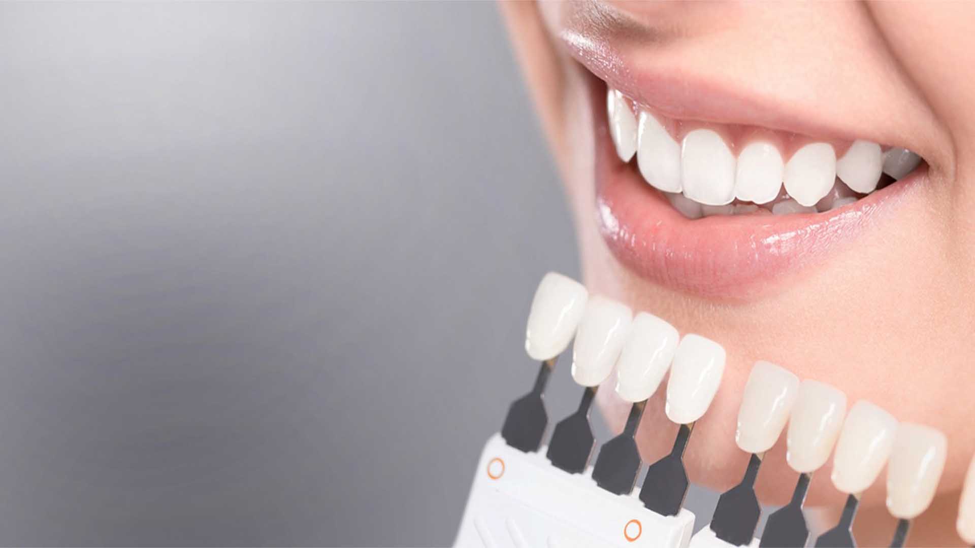 Фотовідбілювання зубів – переваги і нюанси процедури