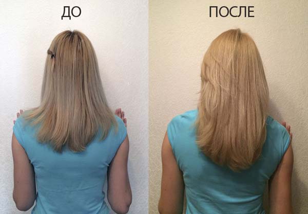 Шляхи для посилення росту волосся: аптекарські засоби та народні рецепти