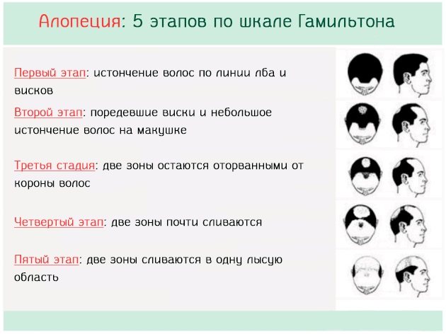 Селенцін від випадіння волосся.  Відгуки.  Шампунь, спрей, лосьйон, маска, бальзам-ополіскувач, таблетки